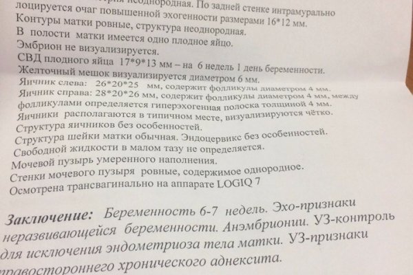 Актуальная ссылка на кракен